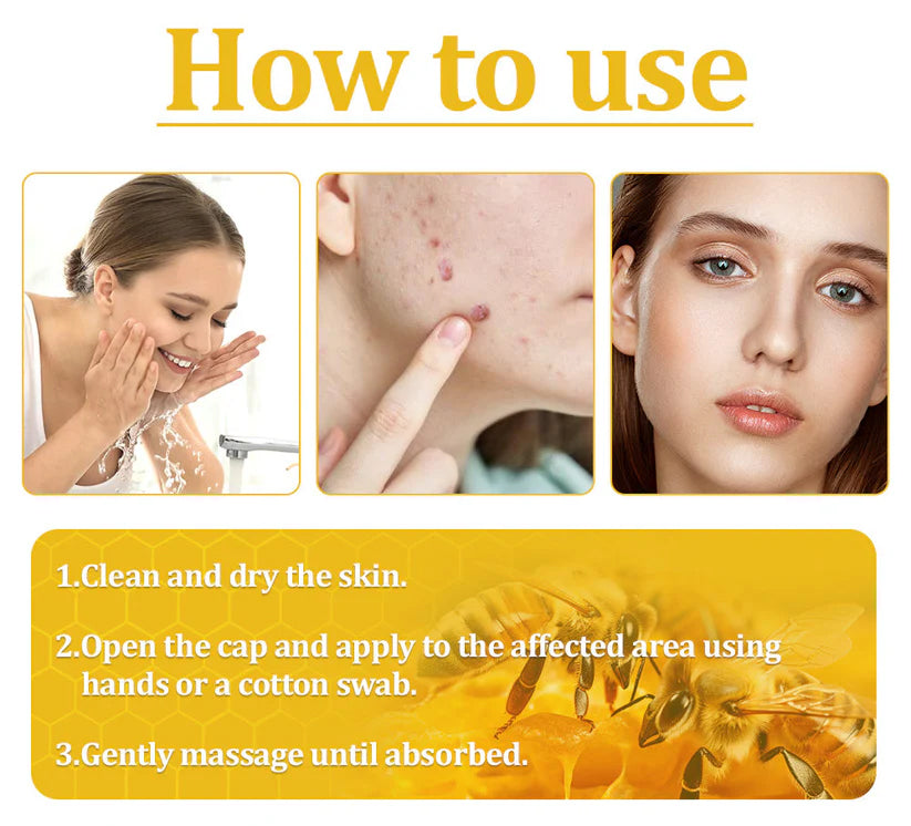 🌟 Last 14Pcs Left | Cvreoz® Bee Venom Skin Treatment Cream