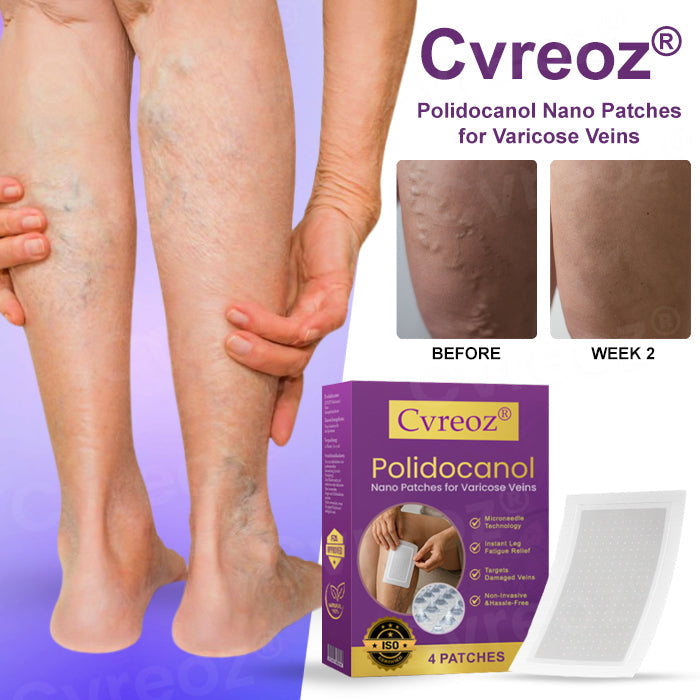 🔥Hot Sales - 50% OFF🌿Cvreoz® Polidocanol Nano Patches for Varicose Veins