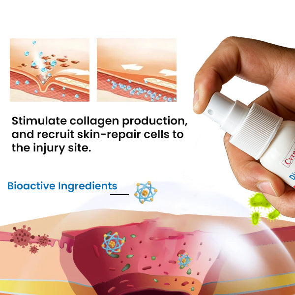 🔥Hot Sales - 50% OFF🌿Cvreoz® Diabetic Foot Healing Spray