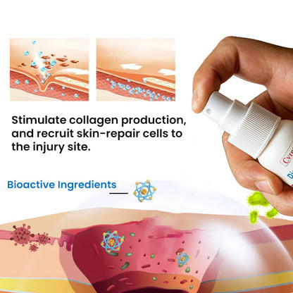 🔥Hot Sales - 50% OFF🌿Cvreoz® Diabetic Foot Healing Spray