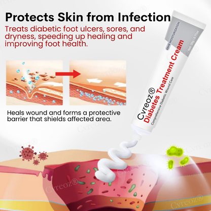 Cvreoz® Diabetes Treatment Cream