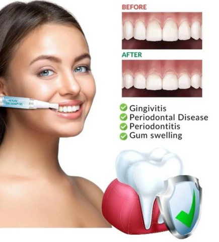 AEXZR™ 🎉 LIMITED TIME OFFER 🎉 Gum Therapy Gel