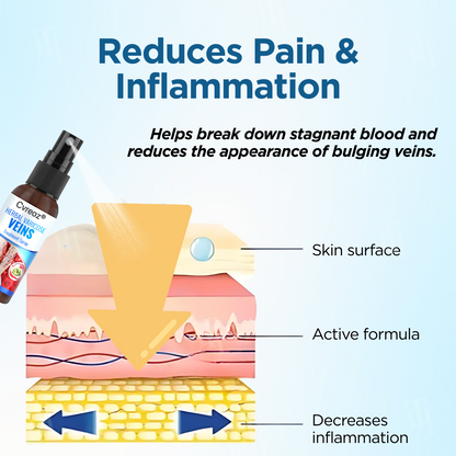 🔥Hot Sales - 50% OFF🌿Cvreoz® Herbal Varicose Veins Treatment Spray