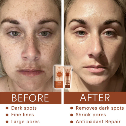 AEXZR® Herbal Spots ✅ 𝕤𝕒𝕧𝕖 𝕦𝕡 𝕥𝕠 𝟟𝟘% Peel-Off Facial Mask