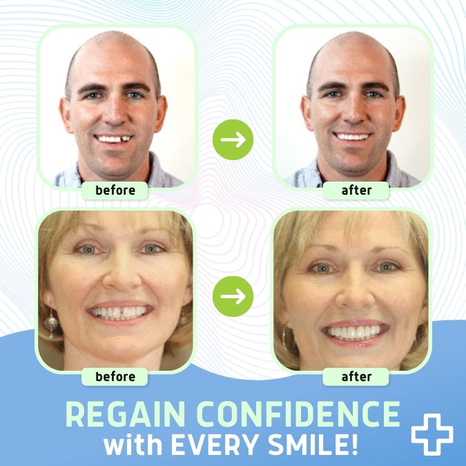 🌟 Official Store | Bikenda® Thermal Forming False Teeth🦷 Transform Your Smile with Confidence!