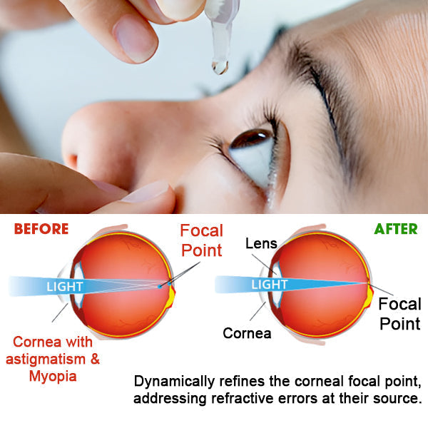 Cvreoz® Eye Care Drops