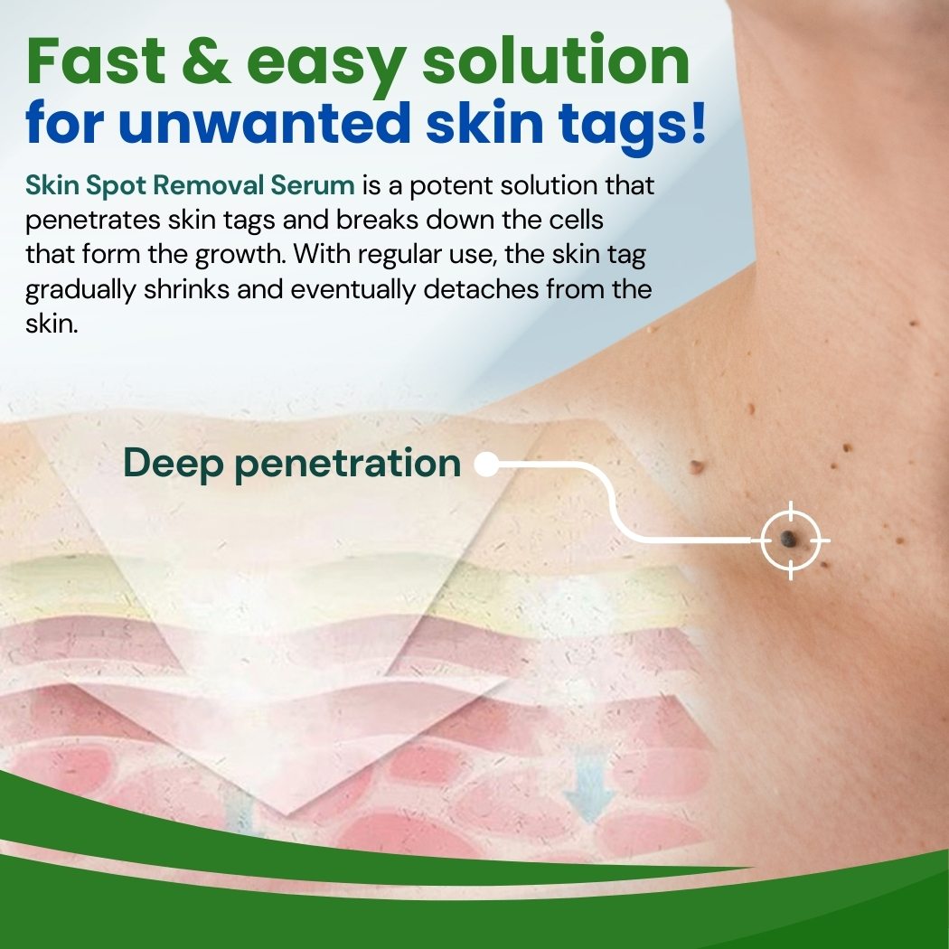 Cvreoz® Skin Spot Removal Serum